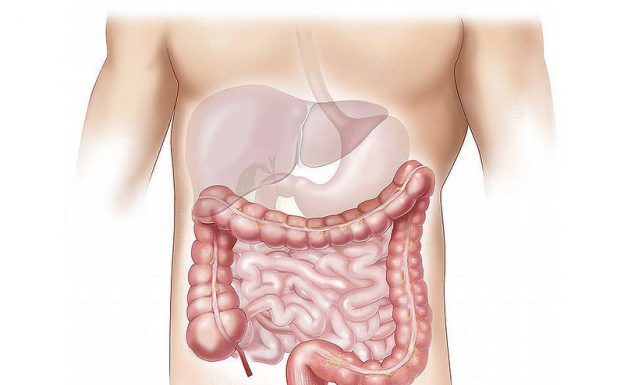 抗生素與腸癌有關聯:使用劑量增加可能增加罹患腸癌風險