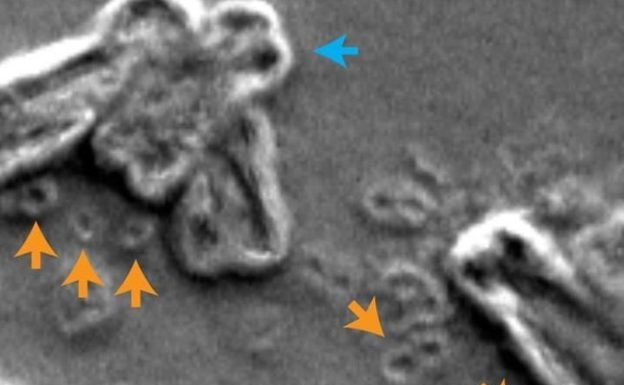 環狀 DNA 加速複製致癌基因,促進腫瘤細胞惡化