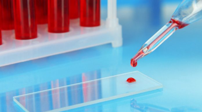 一滴血驗 13 種癌,日本東芝新儀器盼 2021 年實用化